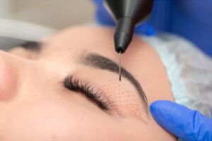 Barbiana by Denisa Lipoliză injectabilă Volumizare buze Nanosoft Dermapen Plasmapen more Pitești
