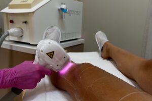 Epilare definitivă Laser Expert Deva