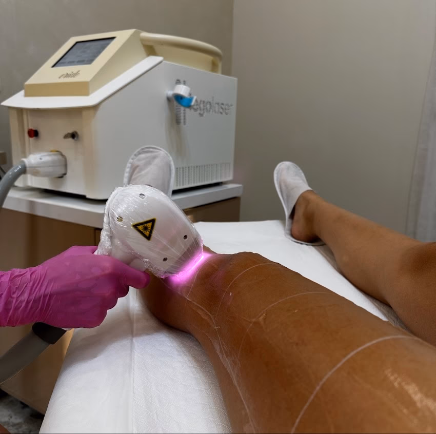 Epilare definitivă Laser Expert Deva