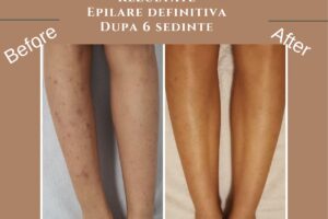 Kaluna Beauty by Oana Fetu