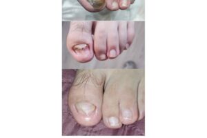 Merypodo Pedimed Srl