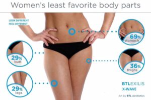 Perfect Body Estetică Corporală Btl